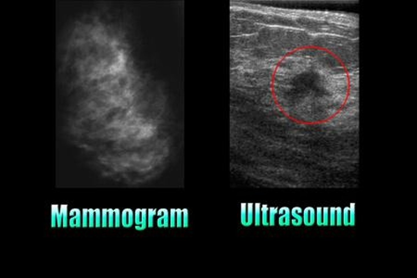<p>It is particularly useful in breast imaging.</p>