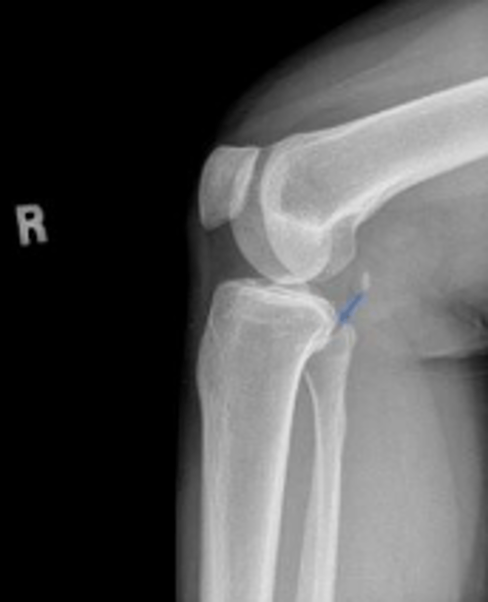 <p>What space are the arrows pointing to?</p>