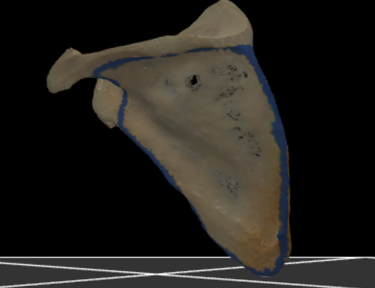 <p>gans het gebied onder de spina scapulae op de facies posterior</p>