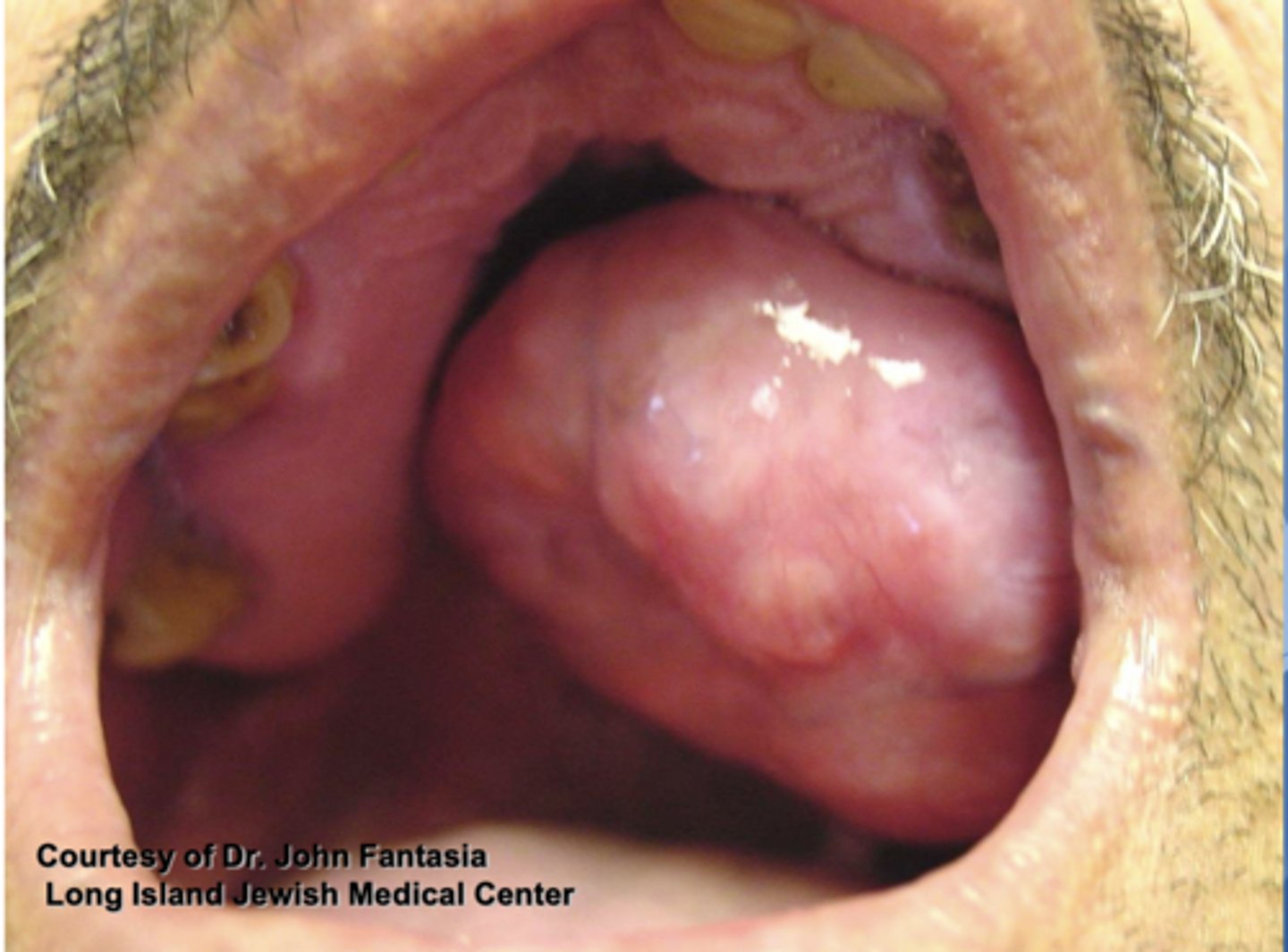 <p>ID the pathology:</p>