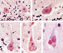 <p>What are these? Why are they important</p>