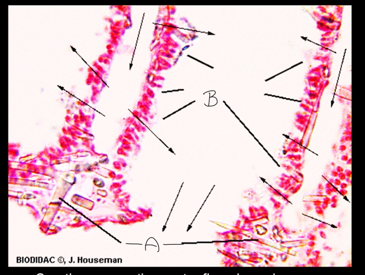 <p>What part of the Grantia is labeled A</p>