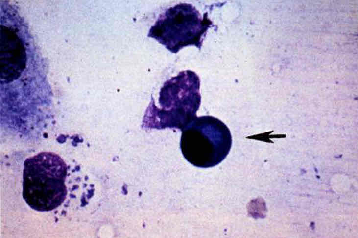 term image