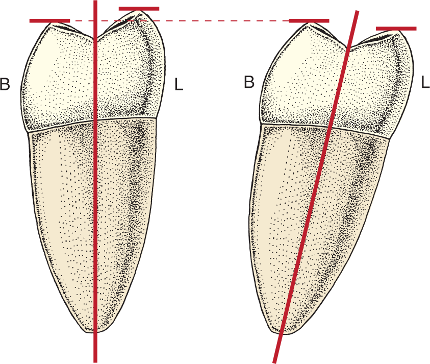 <p>An imaginary line representing the long axis of a tooth, bisecting the root and crown in the cervical area.</p>