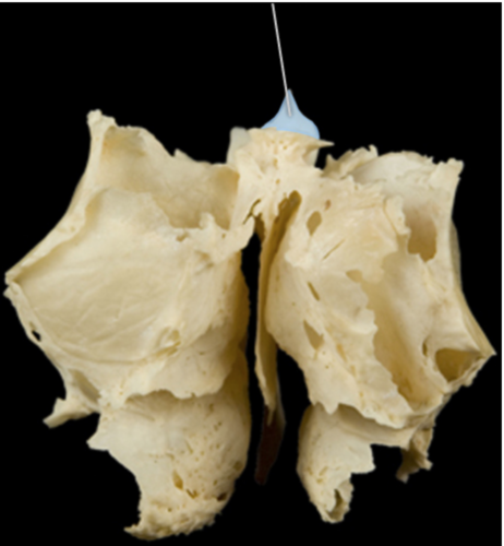 A ridge projecting from the cribriform plate