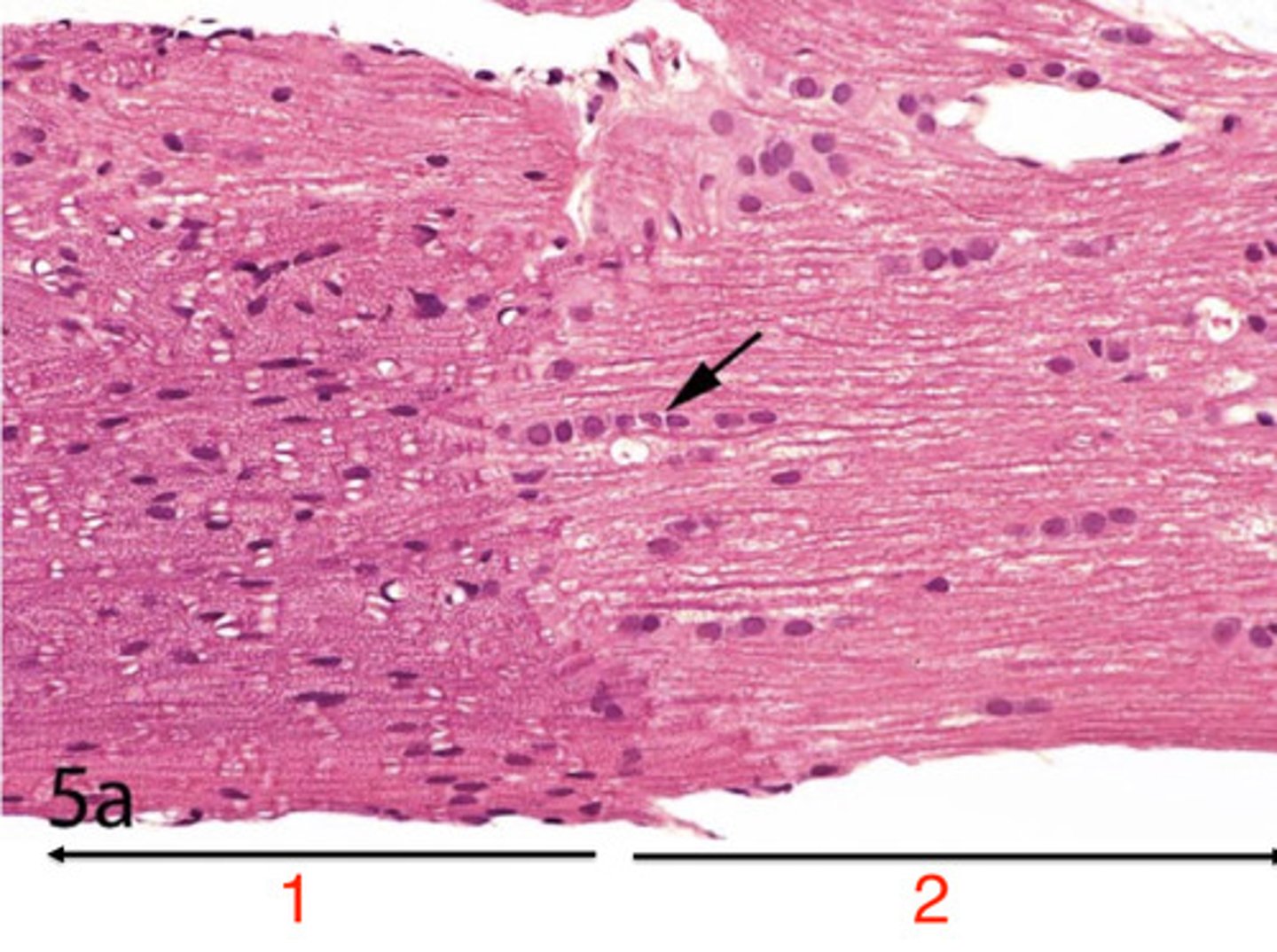 <p>is 1 the CNS or PNS?</p>