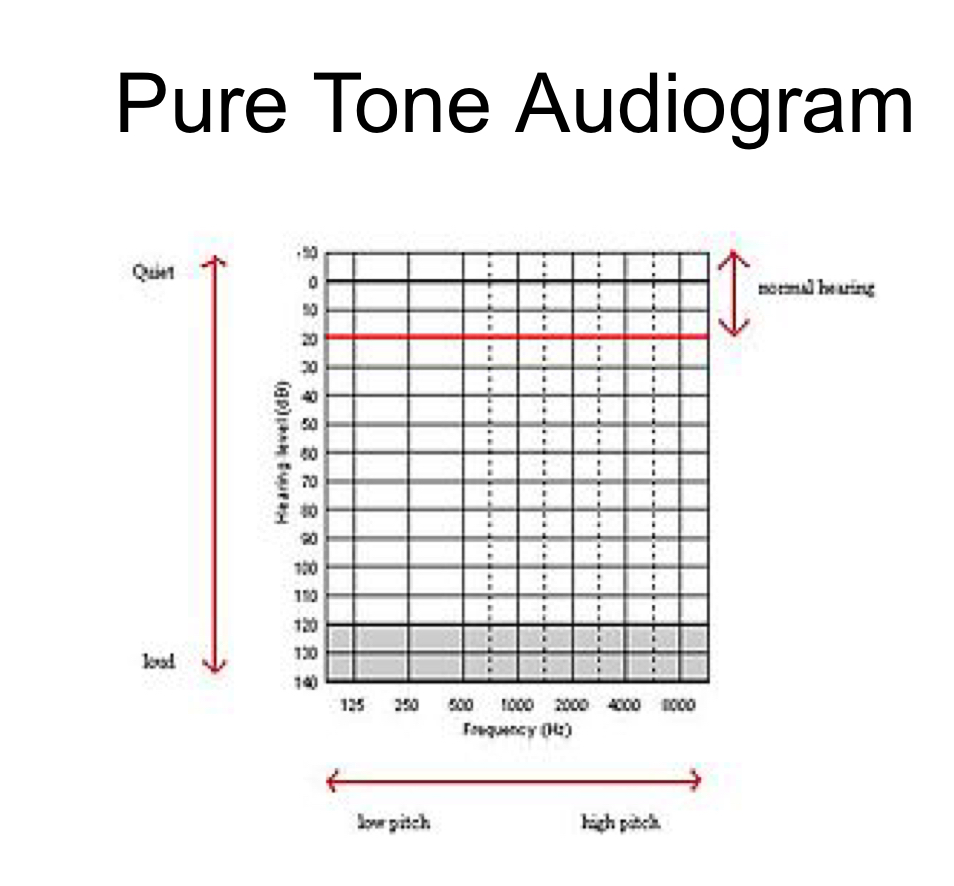 Pure tone audiogram 