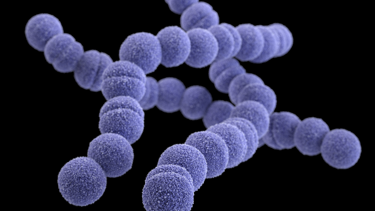 <p>It looks like a purple chain of cocci</p>