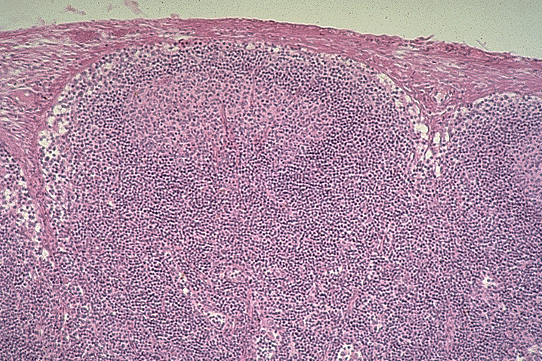 <p><strong>Lymphatic nodules</strong></p>