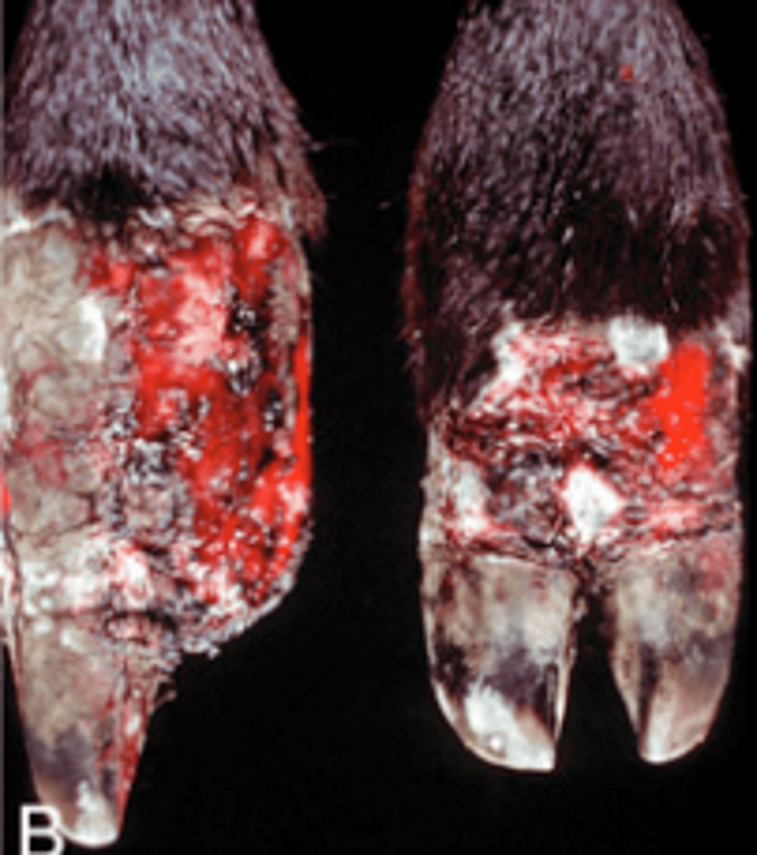 <p>What type of necrosis is being shown in this image?</p>
