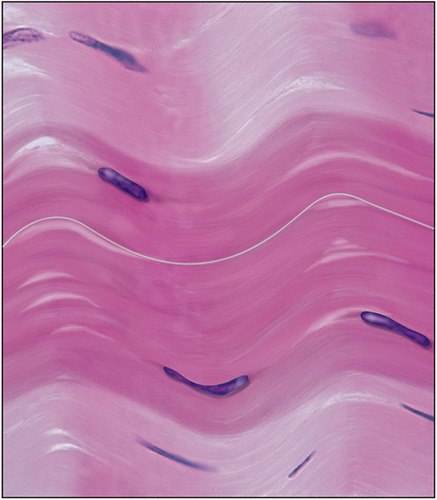<p><strong>What is a picture example of dense connective tissue?</strong></p>