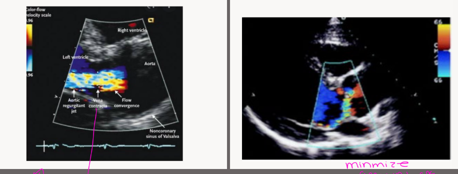 <p>which one is central VS eccentric AR</p>