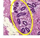 <p>Breast</p><p></p>