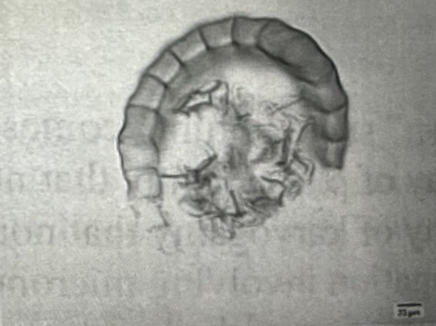 <p>___?___ are produced in this structure (see at right)</p>