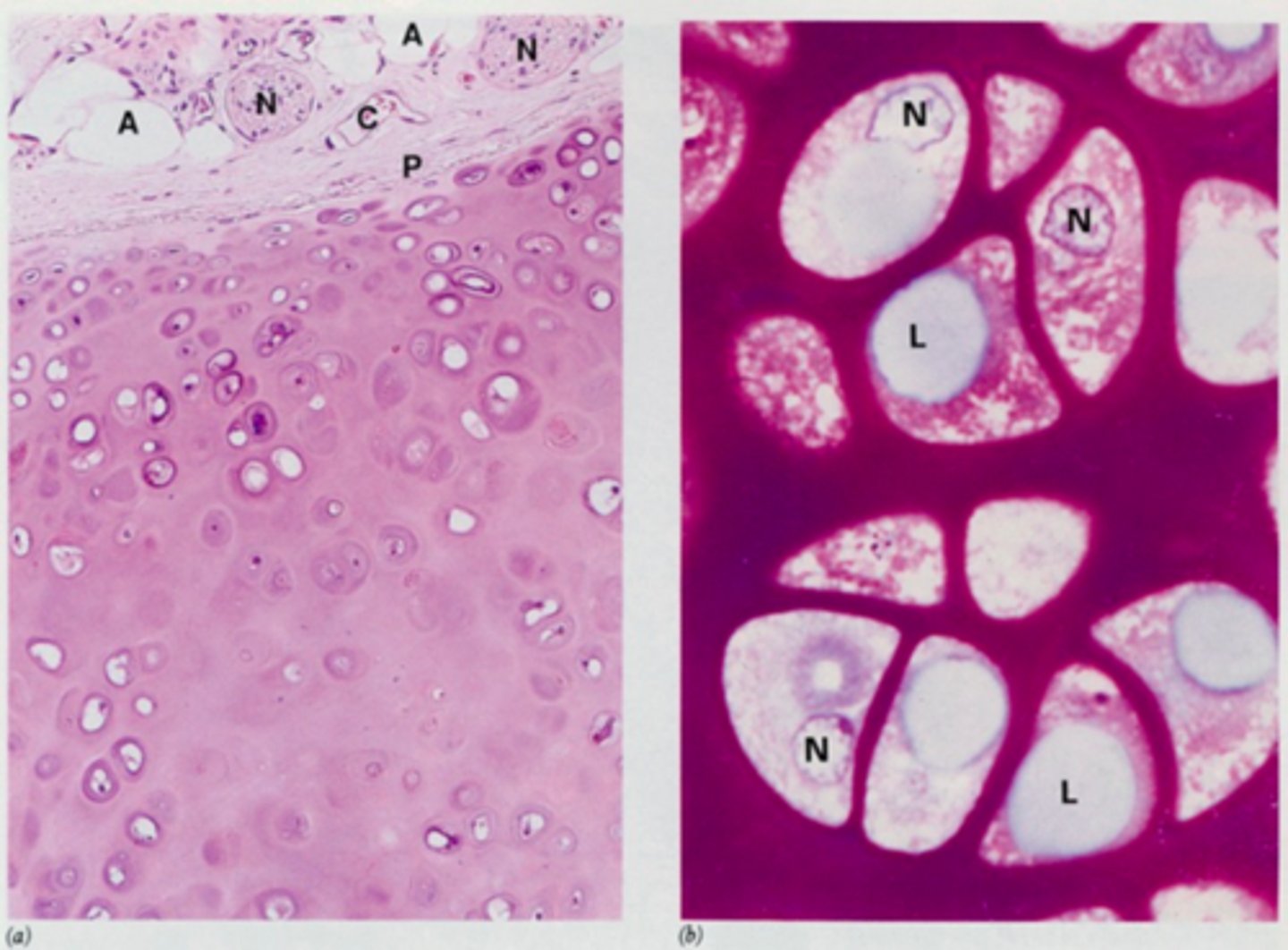 <p>identify the cartilage:</p>