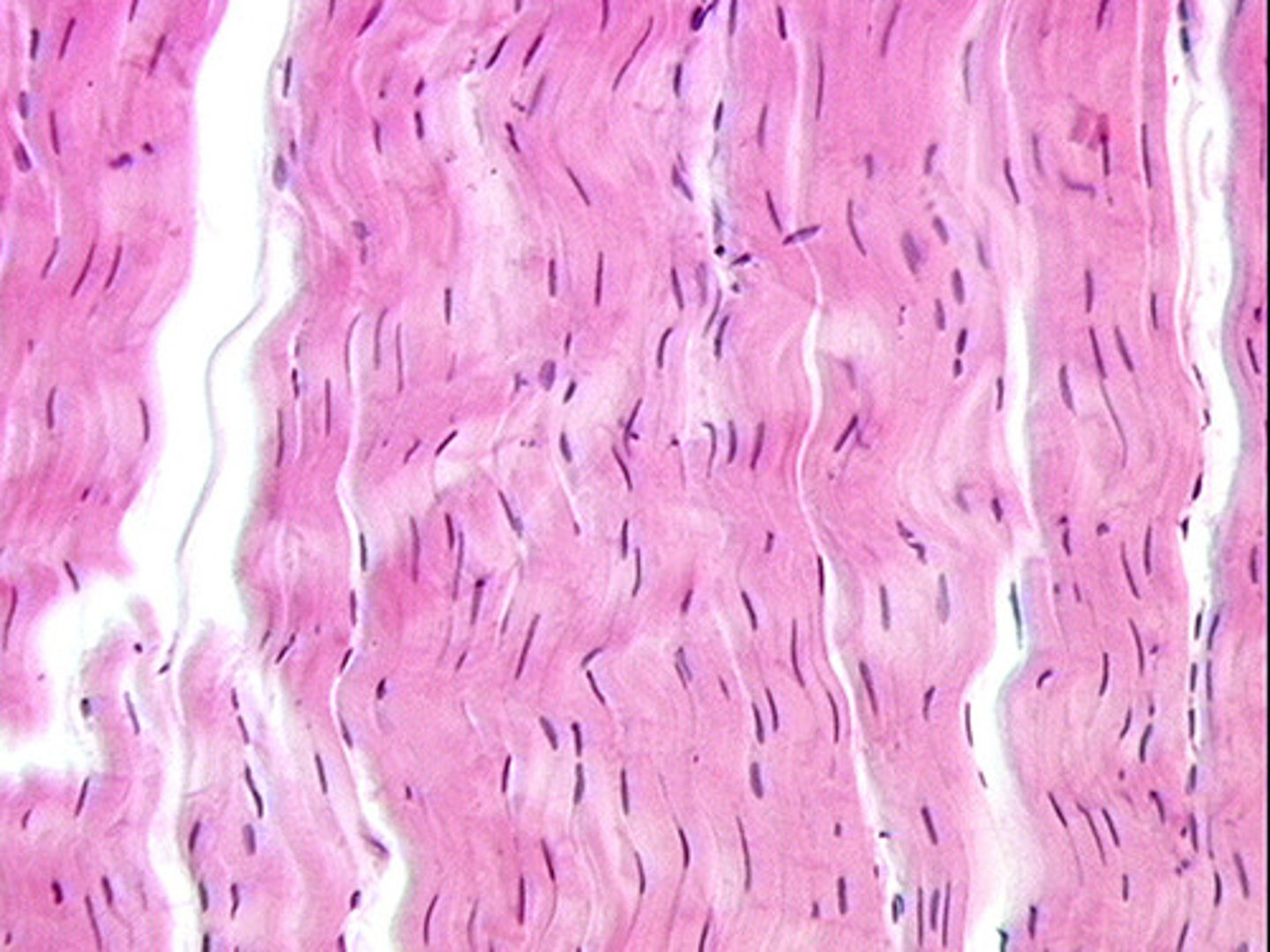 <p>mostly collagenous fibers are parallel and packed tightly together</p><p>contains fibrocytes</p><p>found making up our tendons, ligaments and aponeurosis</p>
