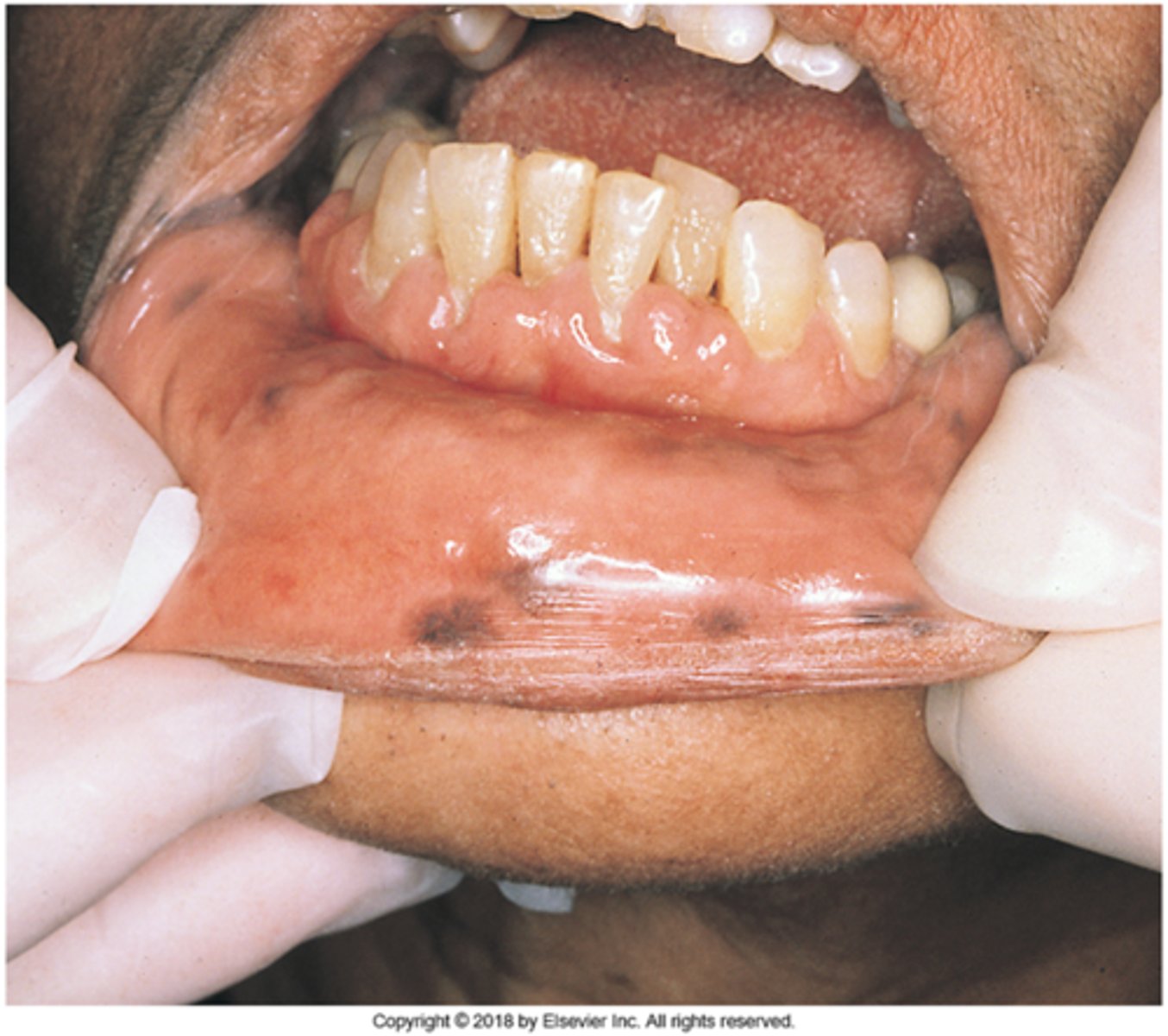 knowt flashcard image