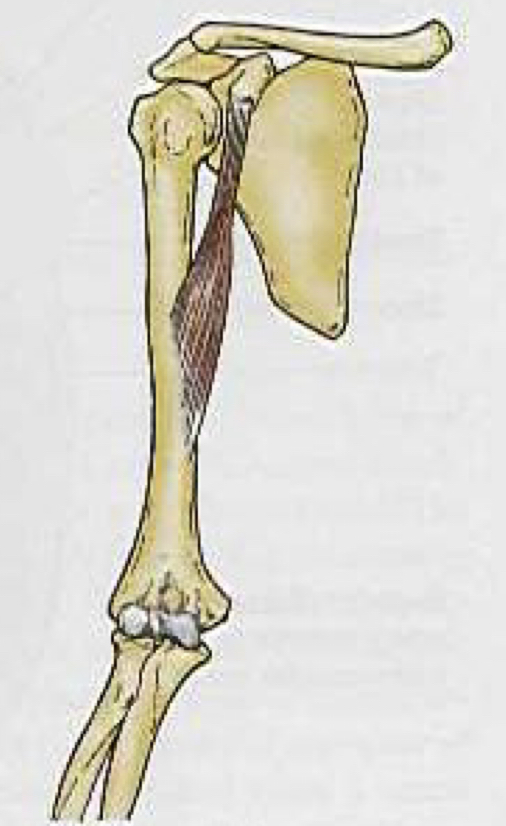 <p>What muscle is this?</p>