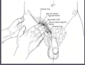 <p><strong>Lymph Node Exam</strong></p><p>-Check the ________ and ________ lymph nodes </p>