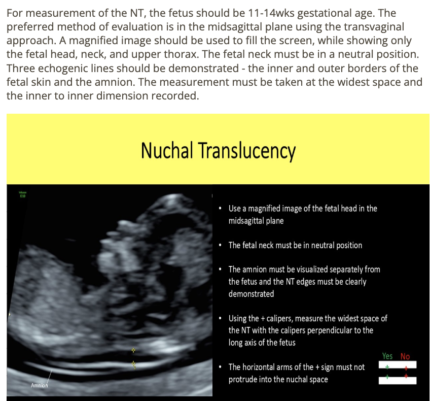 <p>c) the measurement must be taken at the widest space + from inner to inner dimension recorded</p>