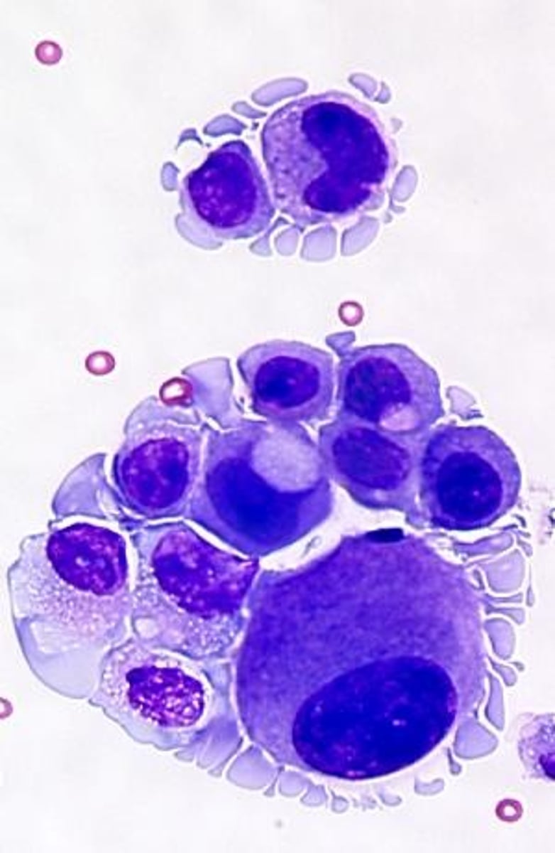 <p>the bulging of the plasma membrane to form apoptotic bodies</p>