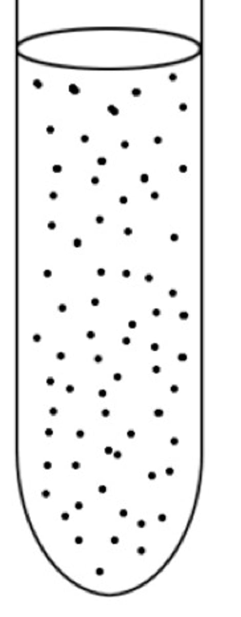 <p>which bacteria is grown in this tube?</p>