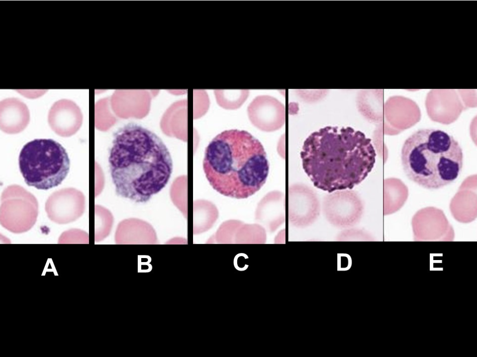 <p>Match the letter in the left column with the specific leukocyte&nbsp;in the right column based on the image below.</p>