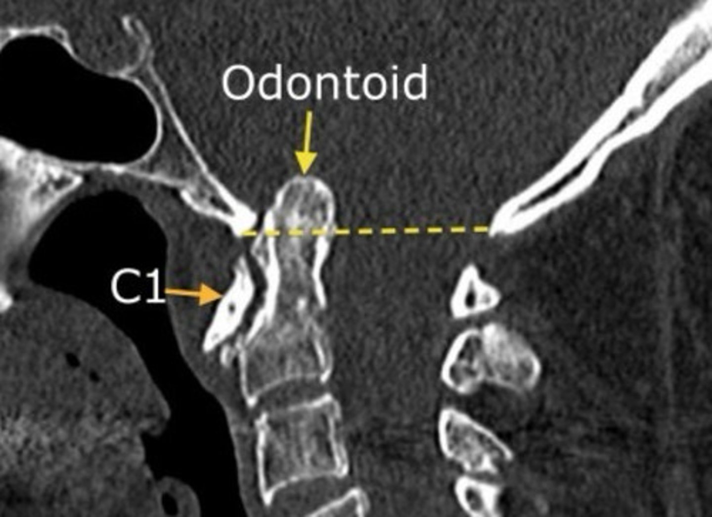 <p>What are we looking at here?</p>