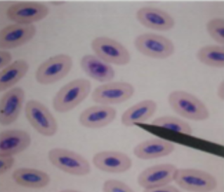 <p>spp wc has large, nucleated, and elliptical rbc</p><ul><li><p>mild degree of polychromasia (prominent in smaller birds)</p></li><li><p>presence of nuclei complicates hematologic evaluation</p></li></ul><p></p>