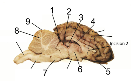 <p>What structure of the brain is this? #1</p>