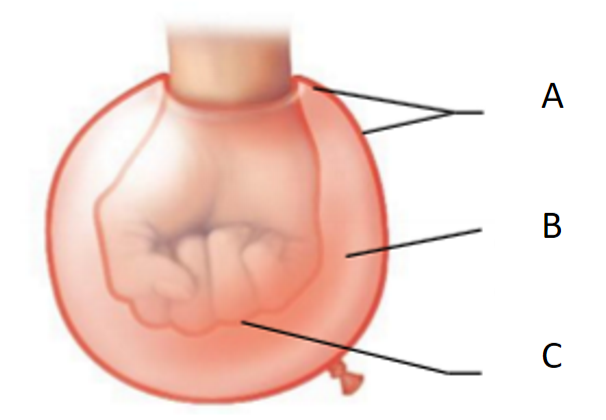 <p>What is the serous cavity? What letter does it correspond to in the image?</p>