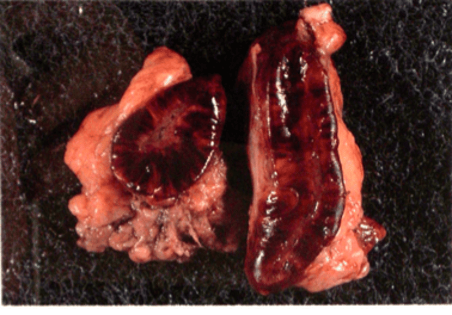 <p>Gennemskåret binyrer fra hest, hvad er den patoanatomiske diagnose?</p>