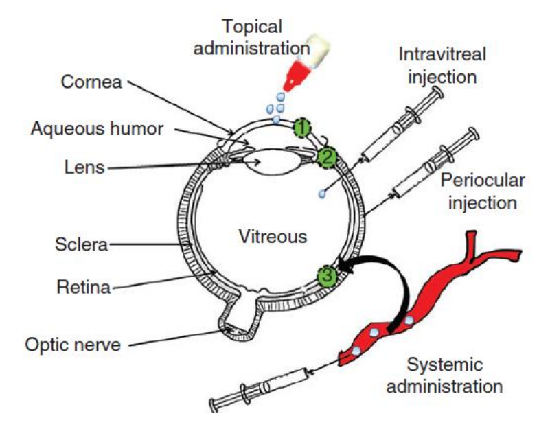 <p>Routes of Ocular Drug Administration</p><ol><li><p><strong>Topical administration </strong>- may deliver drugs to ______ segment of eye (______ and _____), high patient compliance</p></li><li><p><strong>Intravitreal and periocular injections</strong> - deliver drug to the ______ segment (______)</p></li><li><p>^ Which injection is <u>more invasive</u>, <em>intravitreal or periocular</em>?</p></li><li><p><strong>Systemic administration</strong> - delivers drug into ______ segment, still not a successful route due to limited _____ into ocular tissues</p></li></ol>