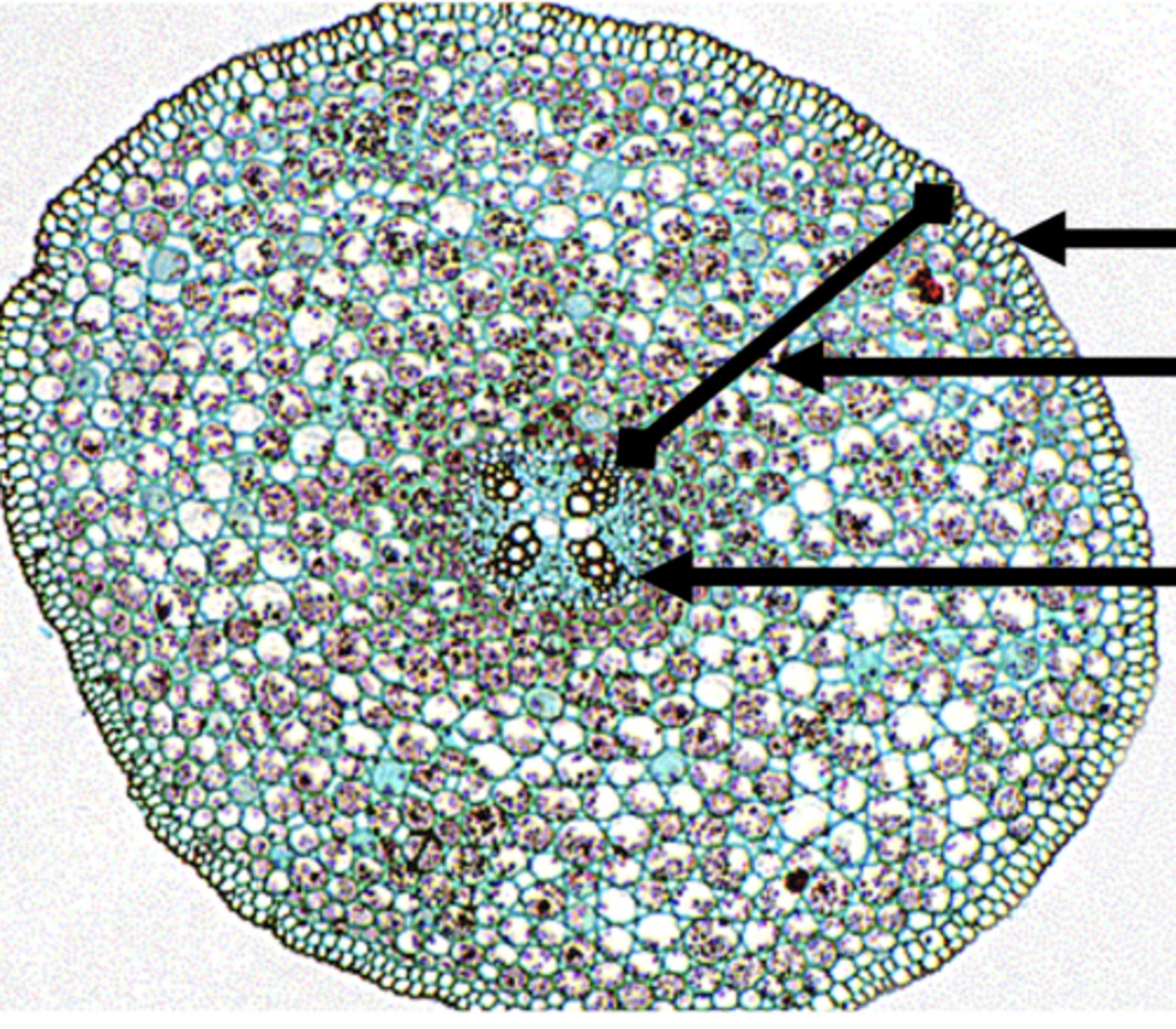 <p>How can you tell that this is an immature dicot root?</p><p>The ______________ in the center has not yet matured into __________.</p>