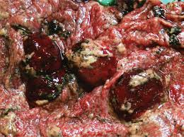 <ul><li><p>Transmitted via ingestion of organisms</p></li><li><p>Edematous fetus &amp; gray foci on liver</p></li><li><p>Carrier sheep shed Campy in their excretions</p></li><li><p>Culture campy from abomasal fluids</p></li><li><p>Vaccinate <mark data-color="yellow" style="background-color: yellow; color: inherit">ewes @ breeding and booster @ 2nd month of gestation</mark></p></li></ul><p></p>