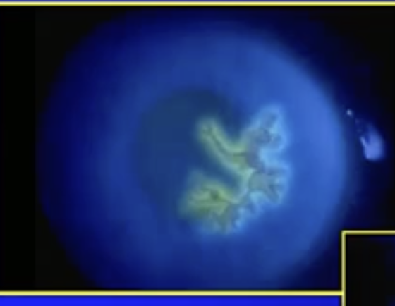 <p>what’s been identified here</p>