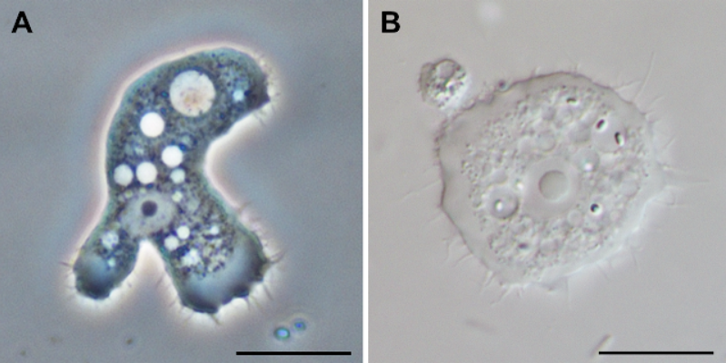 <p>Acanthamoeba spp. (A. trophozoite, B. Cyst)</p>