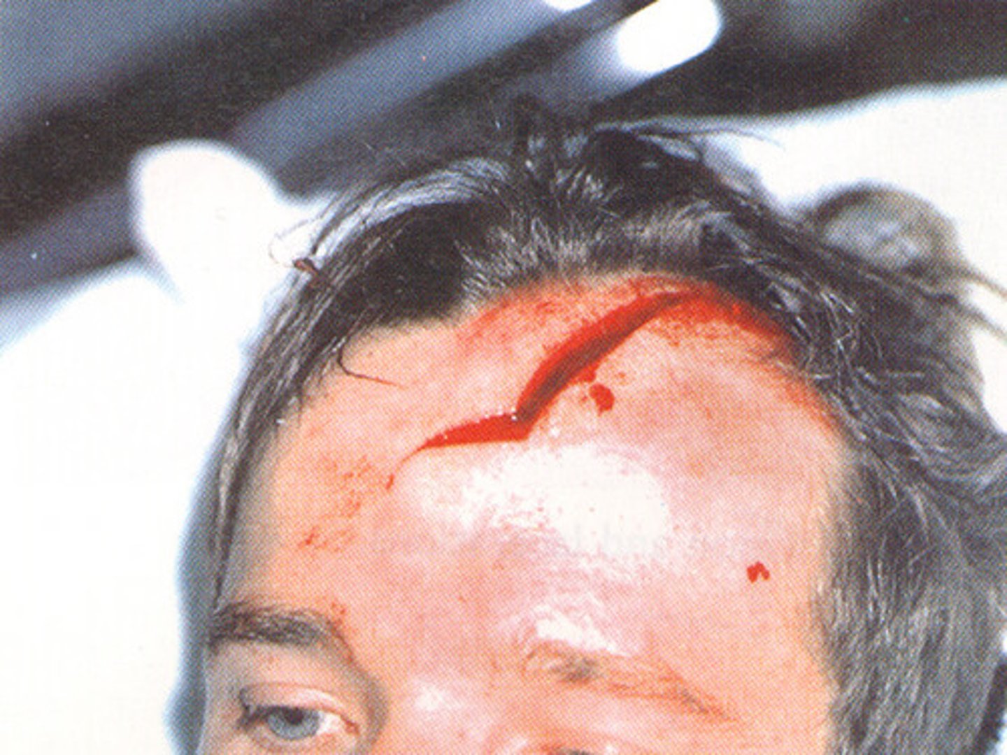 <p>a deep cut or tear in skin or flesh.</p>
