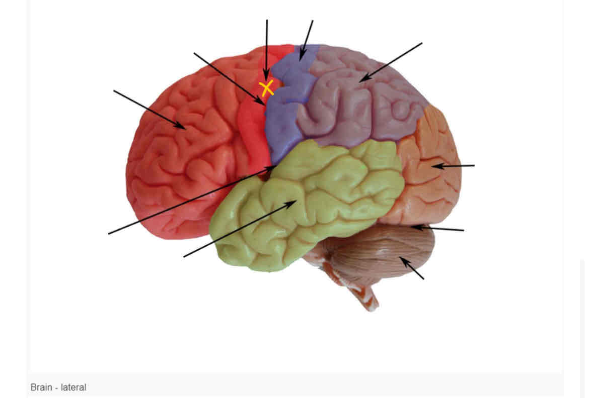 term image