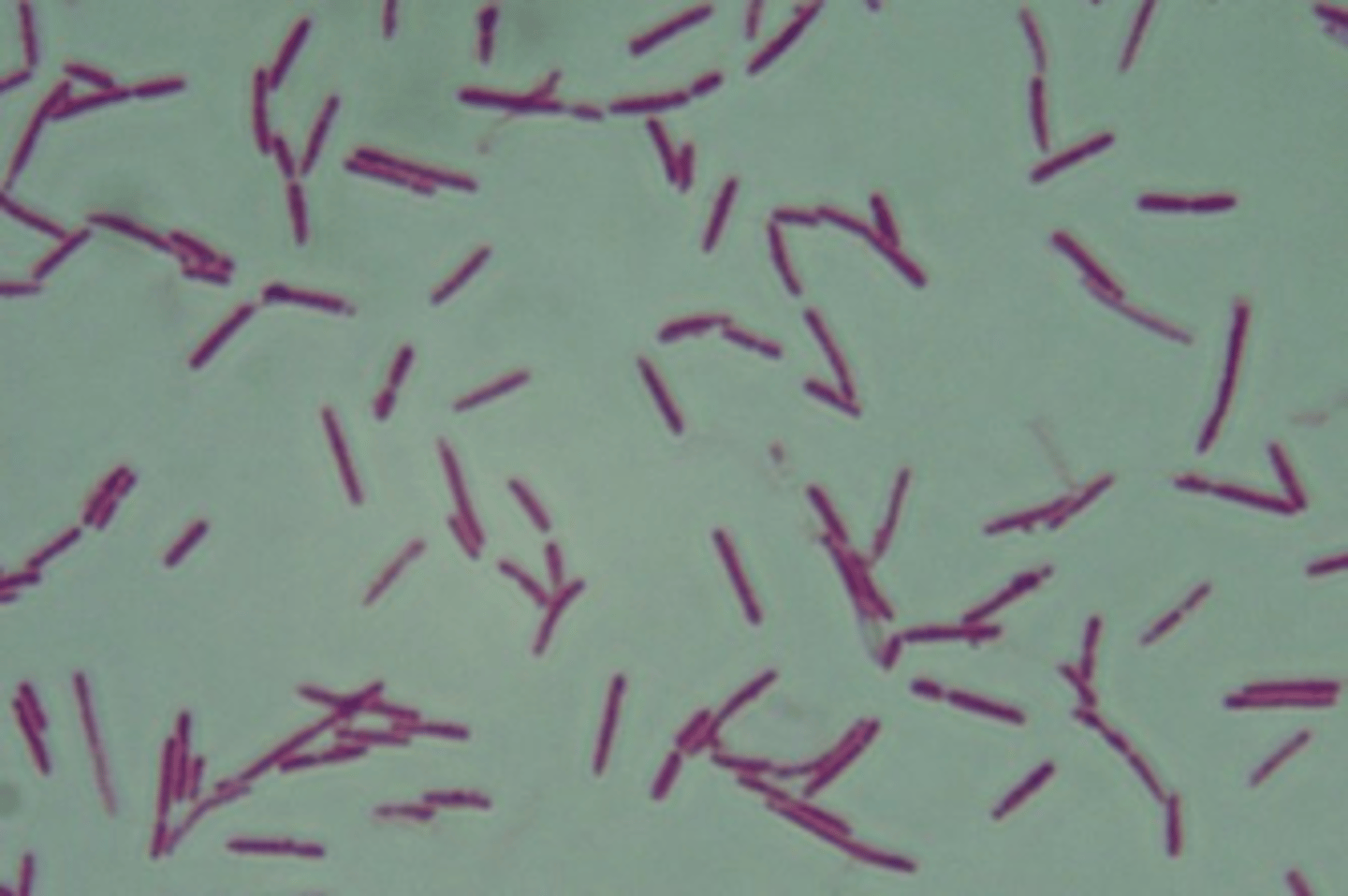 <p>what organism is indicated here that causes black disease</p>