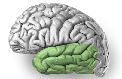 <p>What lobe is this?</p>