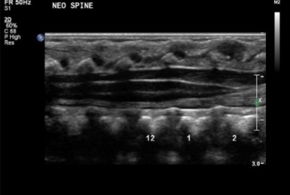 <p>Which imaging modality was used for this scan?</p>