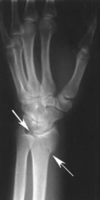 term image