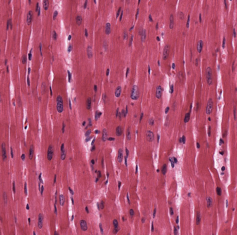 <p>What tissue is this?</p>
