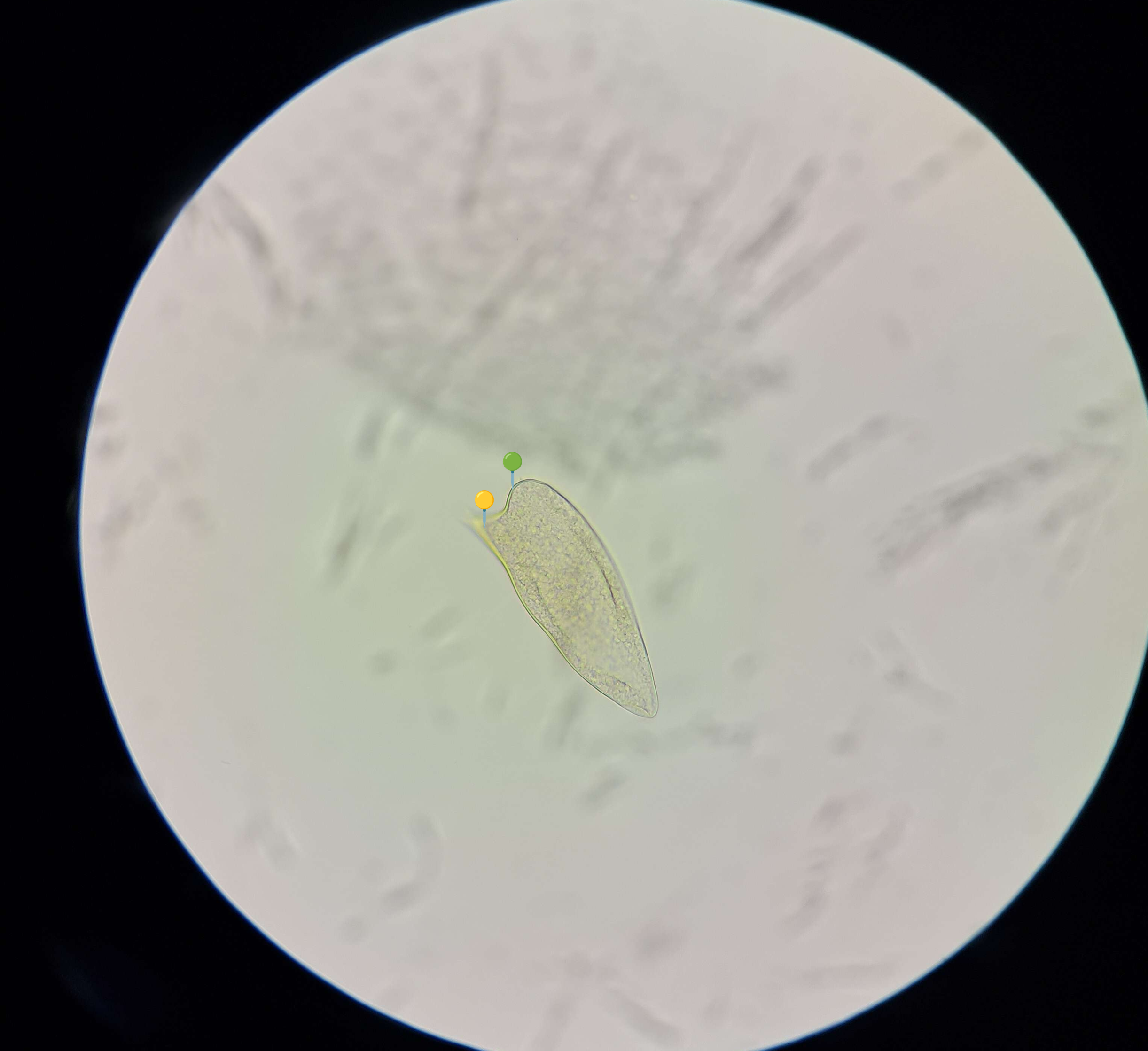 <p><span data-name="worm" data-type="emoji">🪱</span><span data-name="bricks" data-type="emoji">🧱</span><span><span> </span></span><strong><em>Schistosoma mansoni </em></strong><sub>(Jaja)</sub></p><p></p><p></p><p><span>🧩🦠 </span><strong>Organelle:</strong></p><p></p><ul><li><p><span>🟡 - kolec;</span></p></li></ul><p></p><ul><li><p><span>🟢</span> - skorupka.</p></li></ul><p></p><p></p><p><span>😷❓ </span><strong>Parazytoza:</strong><em> Schistosomoza przewodu pokarmowego</em></p>