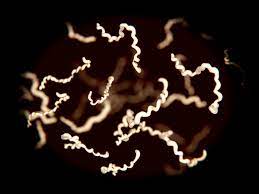 <p>The bacteria in the following figure can cause: </p>