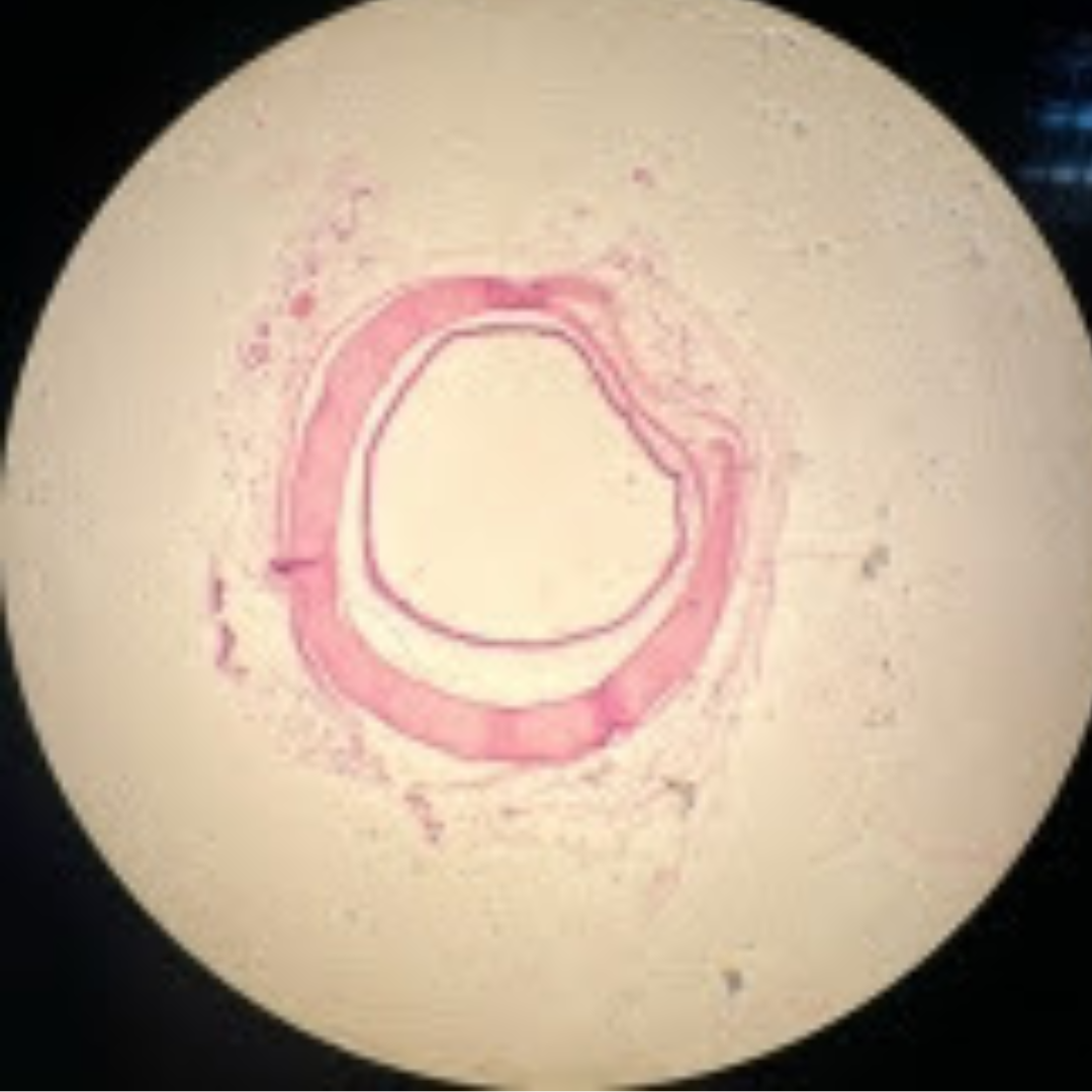 term image