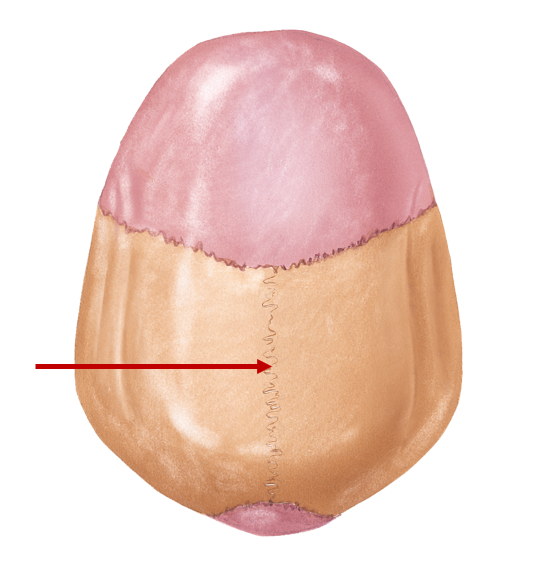 <p>Sagittal plane (like my hairline) - connects two parietal bones (splits in half)</p>