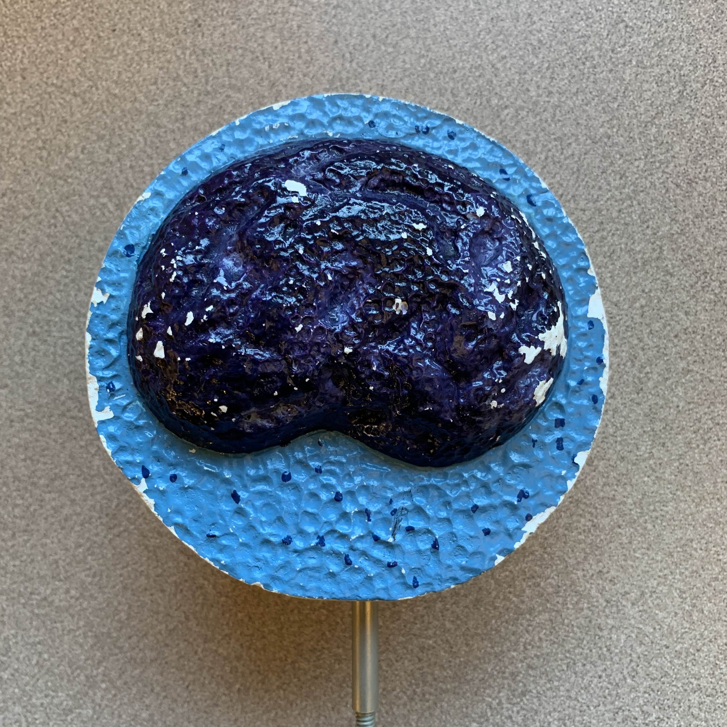 <p>Which type of WBC (leukocytes):</p><p>__ - (20-30%) large single nuclei, limited cytoplasm.</p><p>→ Virus, chronic infection, Mononucleosis, lymphocytic leukemia</p>