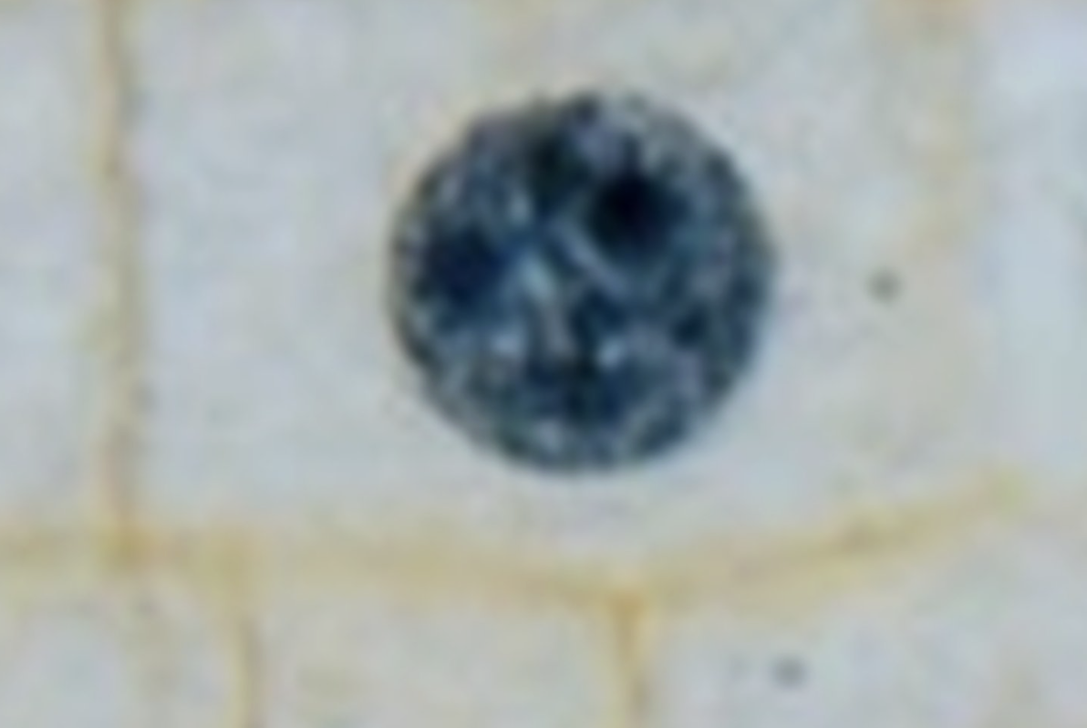 <p>What is the image?</p>